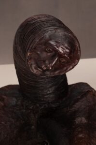 Vulnus